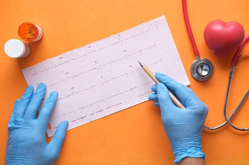 Aumento del rischio cardiologico un mese dopo l’infezione da SARS-CoV-2